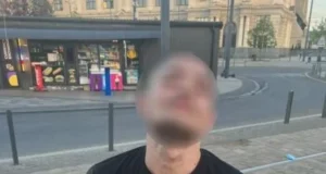 У Львові затримали підозрюваного у пограбуванні жінки на візку