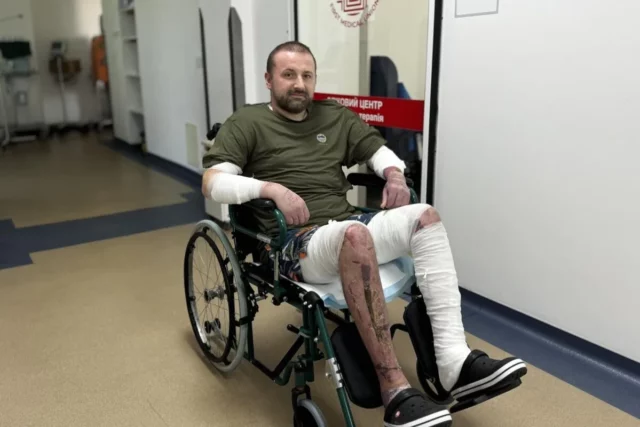 image У Львові шкіра риби та свині допомогла врятувати чоловіка з 80% опіків тіла